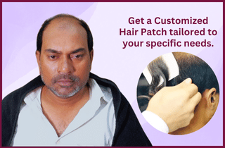Customized Wigs and Patches services