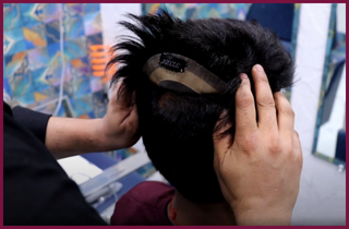 Hair patch Clipping Services